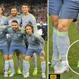 Ronaldo’s tippy-toe trick is the height of vanity