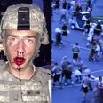US Army cadets’ 1,000-strong pillow fight ends in bloody mass brawl (Video)