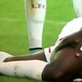 Mignolet injures Kolo Toure…then stupidly treads on his leg (Video)