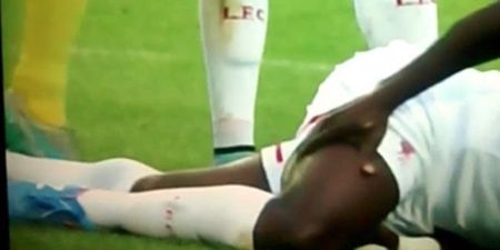 Mignolet injures Kolo Toure…then stupidly treads on his leg (Video)