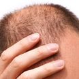 Men should avoid this one particular hairstyle because it makes you go bald…