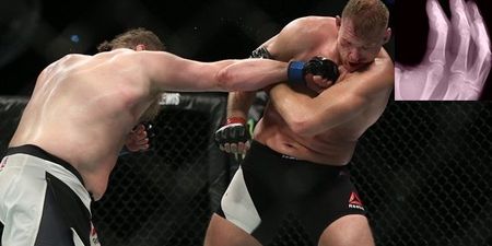 We’re no doctors but we reckon Roy Nelson just might have broken his hand (Pic)