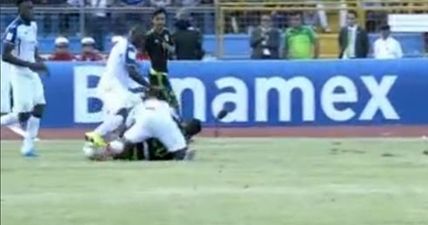 Honduras player could well have suffered the most horrific leg break in football [Warning: Graphic video]