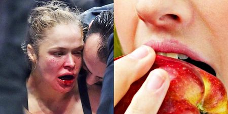 Ronda Rousey: My jaw is so f*cked I can’t even eat an apple