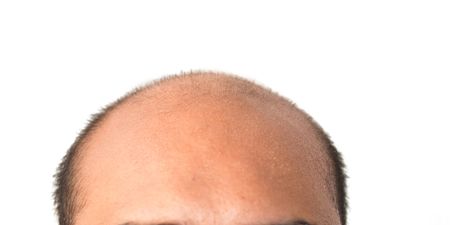 Moscow man is trying to sue ‘Russia’s Google’ for publishing so much bad news he became bald