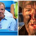 Jeremy Clarkson looks bloodied and bruised after ‘most dangerous stunt I’ve ever attempted’