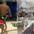 Michael Page describes the moment he landed the skull-fracturing knee on Cyborg Santos