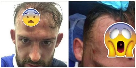 Steven Fletcher’s horrific head gash is not for the squeamish