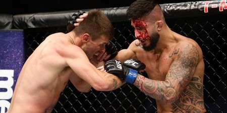 You may have missed this very gruesome injury at UFC 202