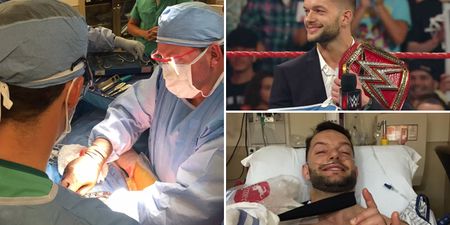 Finn Balor shows off massive scar following SummerSlam injury