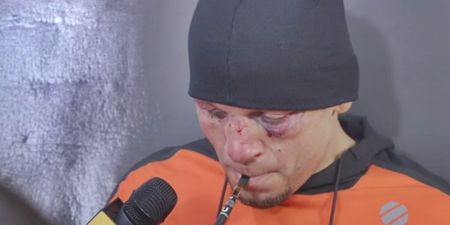 Nate Diaz cleared of taking cannabis by NSAC but could still face drugs ban
