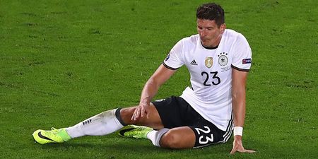 Mario Gomez’s bizarre injury sounds like a right pain in the arse