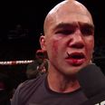 Robbie Lawler issues stern response to the Georges St-Pierre UFC contract debacle