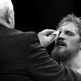 UFC Belfast loses main event as Gunnar Nelson suffers injury