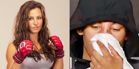 Miesha Tate shares painful looking selfie after nose surgery