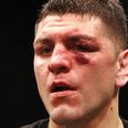 NSAC may remove marijuana from the banned list not long after infamous Nick Diaz ban