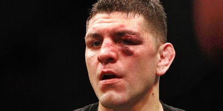 NSAC may remove marijuana from the banned list not long after infamous Nick Diaz ban