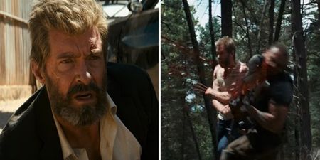 The new trailer for Logan goes heavy on the violence and gore