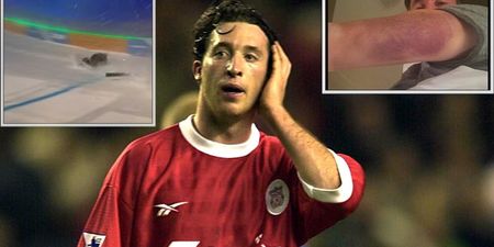 Robbie Fowler took a dreadful fall on The Jump and his arm is now more bruise than arm