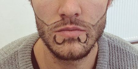 Beard transplants are a thing and a reality TV star just paid a lot of cash for one