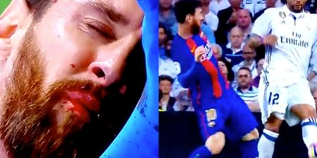 Watch as Lionel Messi is left bloodied by Marcelo’s elbow in El Clasico