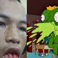 [GRAPHIC] Muay Thai injury will make you feel silly for ever believing that you’ve actually had a cut lip