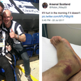 Newcastle United fan dubbed ‘Ultimate Geordie’ after breaking both heels jumping off pub roof