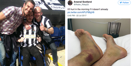 Newcastle United fan dubbed ‘Ultimate Geordie’ after breaking both heels jumping off pub roof