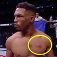 Daniel Cormier defied UFC orders when he referenced fighter’s infection on broadcast