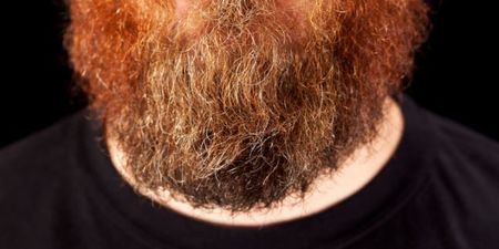 Ever wonder why some non-ginger men end up with ginger beards?