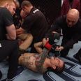 Broken foot, bloodcurdling screams and a horizontal interview on the UFC 222 card