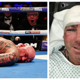 Lucas Browne posts recovery pics after brutal knockout from Dillian Whyte