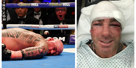 Lucas Browne posts recovery pics after brutal knockout from Dillian Whyte