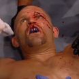 Chuck Liddell dead serious about taking arguably the most inadvisable fight imaginable