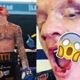 GRAPHIC: Mason Cartwright reveals the extent of horrific mouth injury suffered during Darren Tetley fight