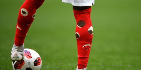 There’s a very good reason that Danny Rose has holes in his socks