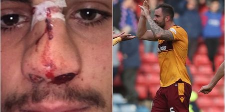 Motherwell captain faces disciplinary hearing for comments on Fabio Cardoso injury
