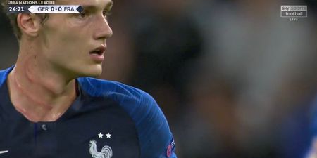 Benjamin Pavard left with Wolverine-esque scars after Antonio Rüdiger scrapes studs down his neck