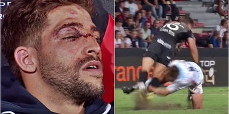 Scrum-half has face “rearranged” by brutal rugby tackle gone wrong