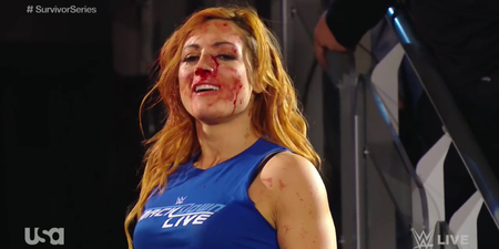 WATCH: WWE release an emotional video of Becky Lynch following her nasty injury last week