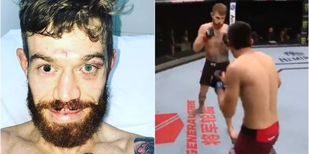 Gruesome eye injury picked up on UFC Argentina card