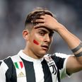 Serie A players to play with red marks on faces to raise awareness of domestic violence