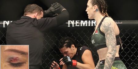 Cat Zingano shows off nasty effects of toe poke to her eye