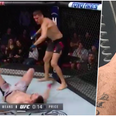 Tim Means suffers gruesome ankle injury after brutal knockout punch