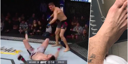 Tim Means suffers gruesome ankle injury after brutal knockout punch