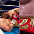 Boxer disqualified for biting David Price in bizarre heavyweight bout