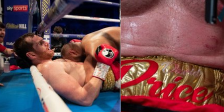 Boxer disqualified for biting David Price in bizarre heavyweight bout