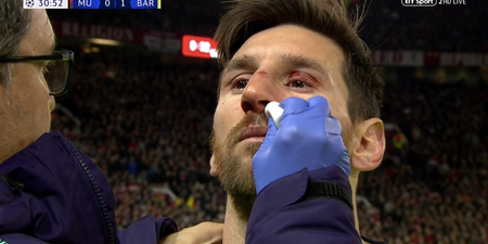 Chris Smalling breaks Lionel Messi’s nose, retirement announcement expected tomorrow