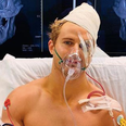 Sage Northcutt reveals eight facial fractures after 29-second horrorshow knockout