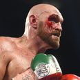 Tyson Fury’s cut against Otto Wallin a wake up call ahead of Wilder rematch